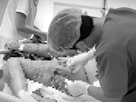 Nguy kịch sau khi tự trích mụn nhọt tại nhà